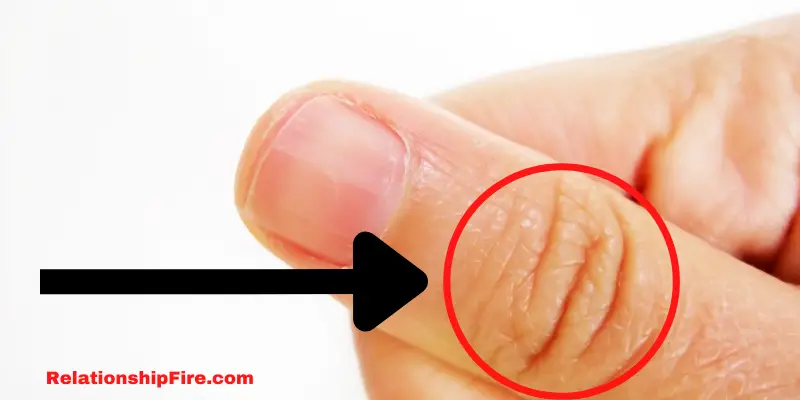 Thumb with red circle around the knuckle lines—Is Your Soulmate’s Initial on Your Left Thumb